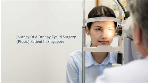 What to Expect Before Droopy Eyelid Surgery | Dream Plastic Surgery