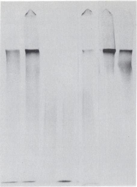 Binding of thrombospondin and thrombin fragment of thrombospondin to ...