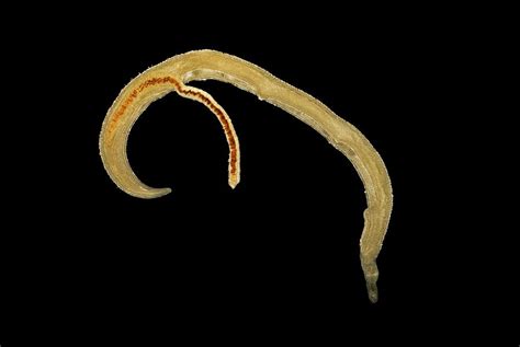 Schistosome Fluke Worm Photograph by Clouds Hill Imaging Ltd - Pixels