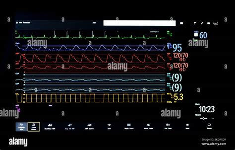 Screen of a bedside patient monitor in an English hospital Stock Photo - Alamy