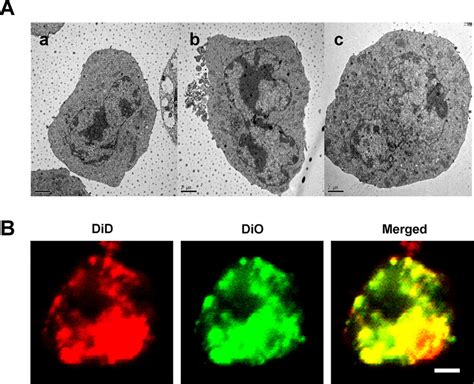 The structure of fusion cells. (A) The TEM images of fusion cells ...