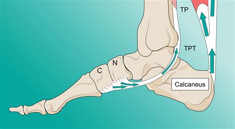 Controlling Talonavicular Joint and Lesser Tarsus Motion related to ...