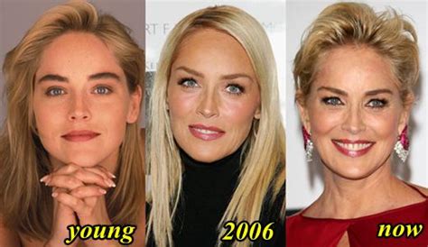 Sharon Stone Plastic Surgery Before And After Photos Botox, Eyelid