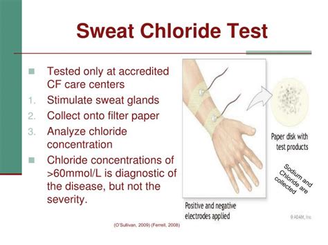 PPT - Cystic Fibrosis PowerPoint Presentation - ID:4201102