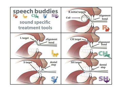 13 best What are Speech Buddies tools? images on Pinterest | Articulation therapy, Speech ...