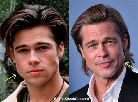 Brad Pitt Plastic Surgery Comparison Photos