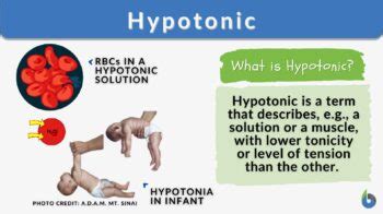 Hypotonic - Definition and Examples - Biology Online Dictionary