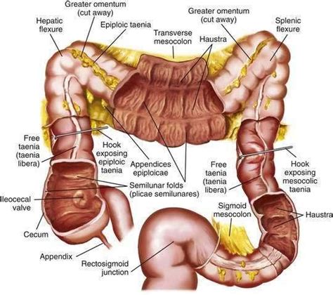 Resultado de imagen para The hepatic and splenic flexures are located ...