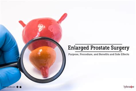 Enlarged Prostate Surgery: Purpose, Procedure, Benefits and Side Effects