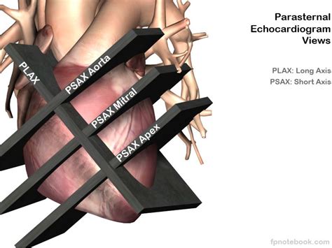 Cardiac sonography, Diagnostic medical sonography, Ultrasound sonography