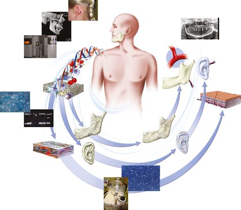 Tissue engineering and surgery: from translational studies to human trials