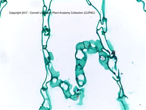 CUPAC ANATOMY SLIDE IMAGES