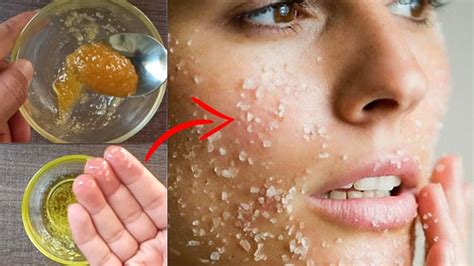 How to Remove Dead Skin Naturally | Best Home Remedies to Remove Dead Skin on Face - YouTube