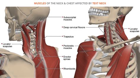 Text Neck: Anatomy of a Modern Spine Condition