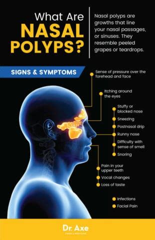 Nasal Polyps: 19 Natural Treatments + Lifestyle Changes - Dr. Axe