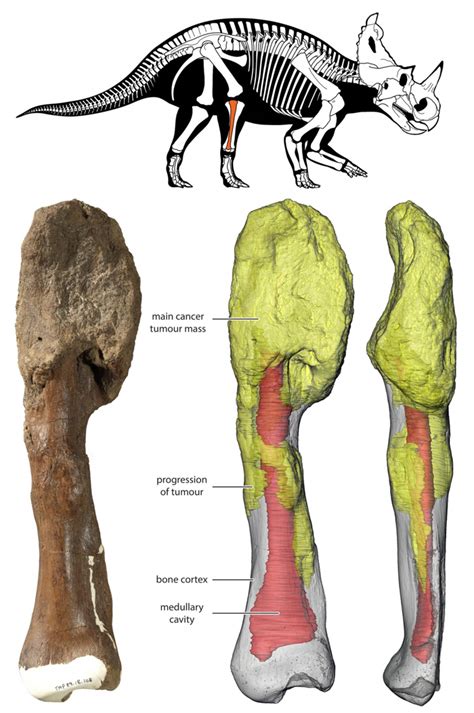 Malignant Bone Cancer Has Been Diagnosed in a Dinosaur For The First Time Ever : ScienceAlert