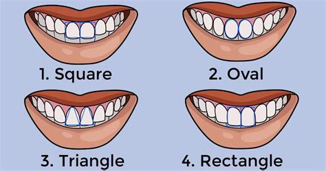 Shape of your teeth reveals a lot about your personality - NeoPress