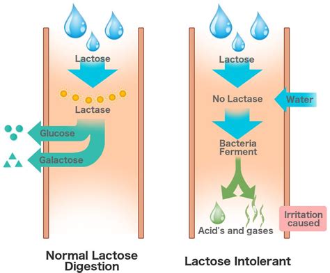 What Is Lactose Intolerance? What Are Its Causes, Symptoms And Signs?