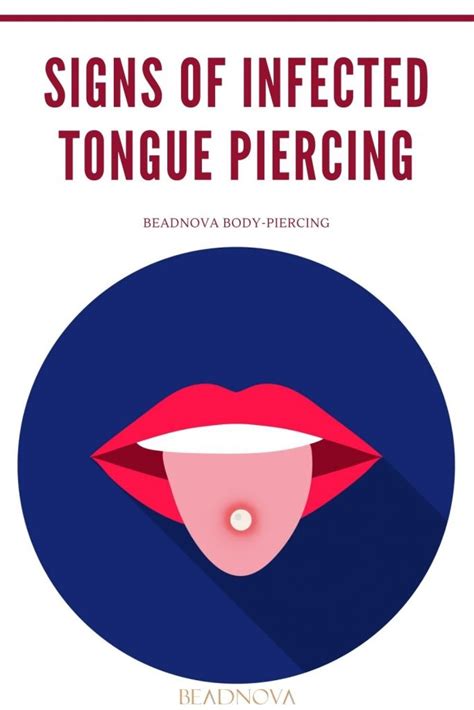 How Do You Treat an Infected Tongue Piercing? - Beadnova