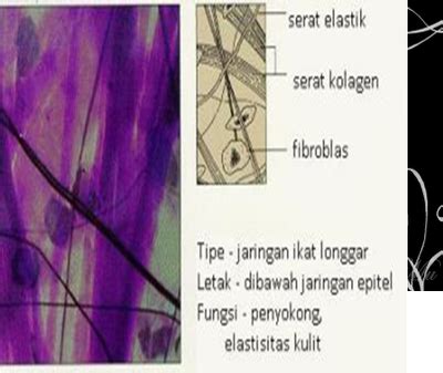 Ma'ruf Media Corp: JARINGAN IKAT LONGGAR