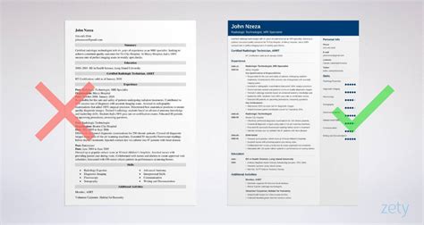 Radiologic Technologist Resume [X Ray Tech Resume Example]