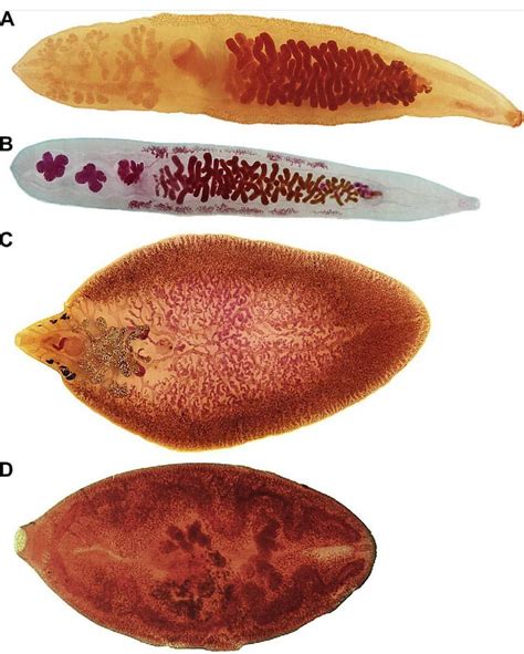 Microbiologia-Bioanalisis® on Instagram: “A. Clonorchis sinensis B ...