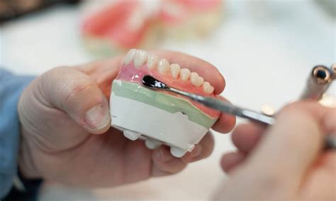 Best Denture Making Materials: Porcelain vs Acrylic