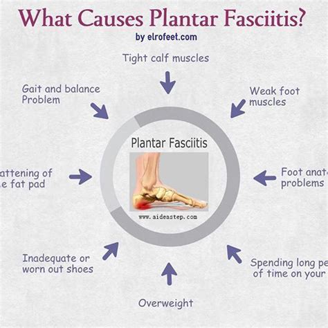 Causes Of Plantar Fasciitis