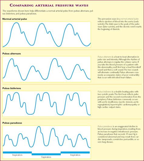 Pin on arterial waves