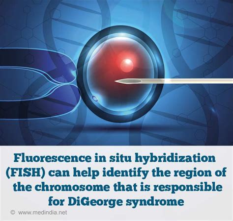 DiGeorge Syndrome - Causes, Symptoms, Diagnosis, Treatment & Prognosis