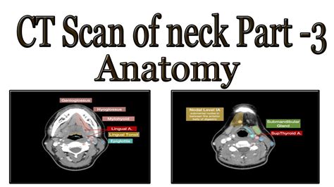 CT scan of neck part 3 anatomy - YouTube