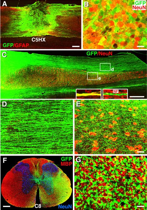 Survival, Differentiation and Growth of Human iPSC-Derived Neural Stem ...