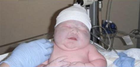 World Guinness Record In Boston World’s Biggest Baby Girl Ever Born | News Today