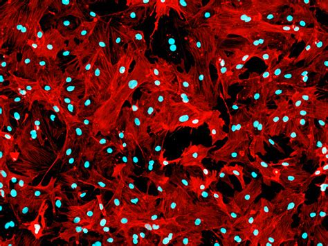 Rat Renal Mesangial Cells - Innoprot Renal Cell System