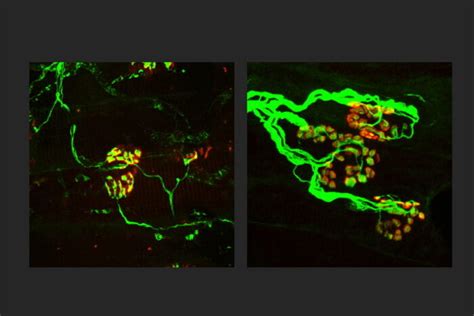 New strategy shows potential to block nerve loss in neurodegenerative ...