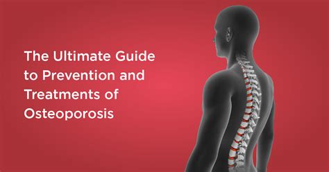 The Ultimate Guide to Prevention and Treatment of Osteoporosis ...