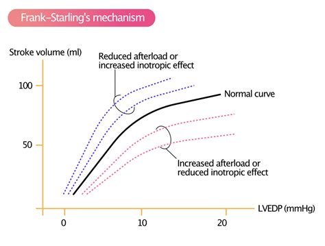 Ventricular Pressure-Volume Relationship: Preload, Afterload, Stroke Volume, Wall Stress & Frank ...