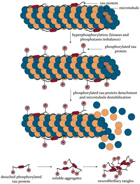 The formation of neurofibrillary tangles through the process of tau ...