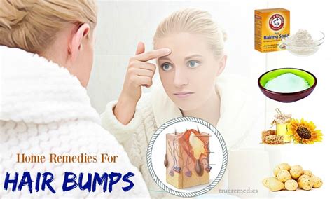 16 Home Remedies For Hair Bumps On Scalp, Face, Neck & Legs