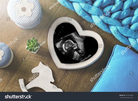 Photo Frame Ultrasound Scan Baby Little Stock Photo 441555409 ...