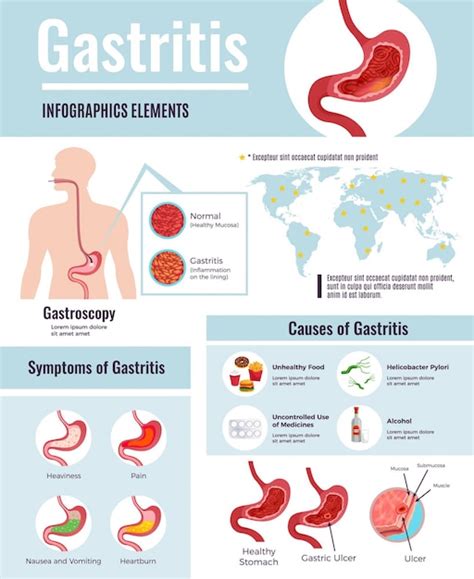 Free Vector | Gastritis symptoms stomach ulcer causes information on unhealthy food habits world ...