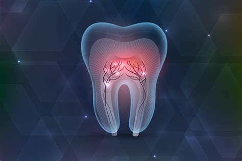 How Long Is the Recovery Process from Root Canal Treatment?