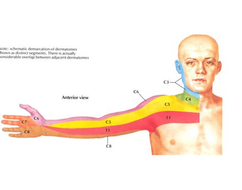 Anterior UE Dermatomes Quiz | Dermatome Map