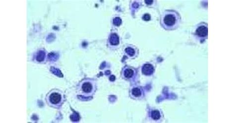 Cryptococcus neoformans - www.medicoapps.org