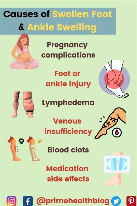 Swollen Ankles and Feet: Causes of Foot & Ankle Swelling in 2023 | Foot ...