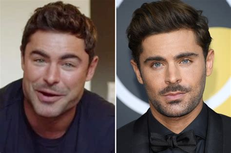 Zac Efron hits back at plastic surgery claims and reveals the real reason for his 'new jaw ...