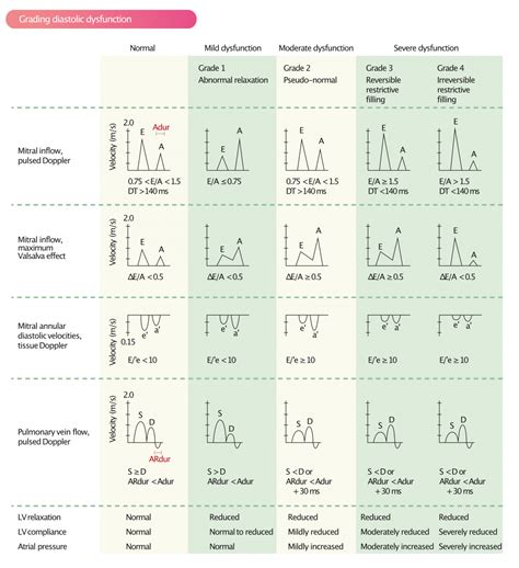 Assessment of diastolic function by echocardiography – Cardiovascular Education