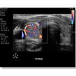 Desonics, Inc. – Thyroid Ultrasound