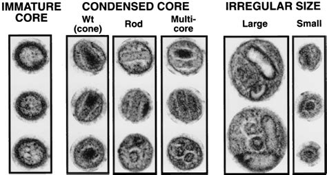 Electron microscopic classification of virion morphology. Three typical... | Download Scientific ...