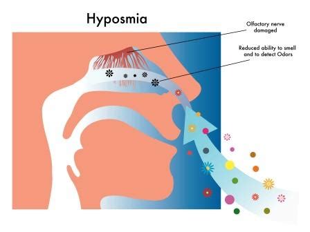 Anosmia: Ayurvedic Treatment And Home Remedies